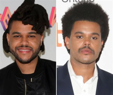 the weeknd before and after