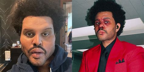 the weeknd current face