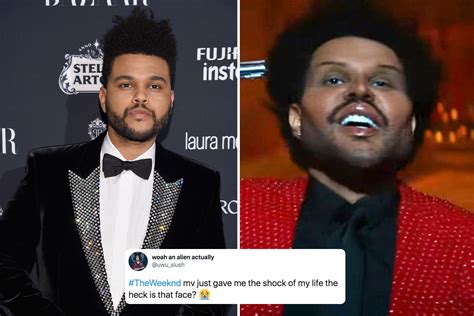 the weeknd plastic surgery save your tears