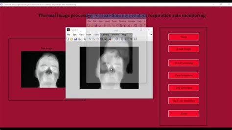 Thermal Camera Image Processing Matlab