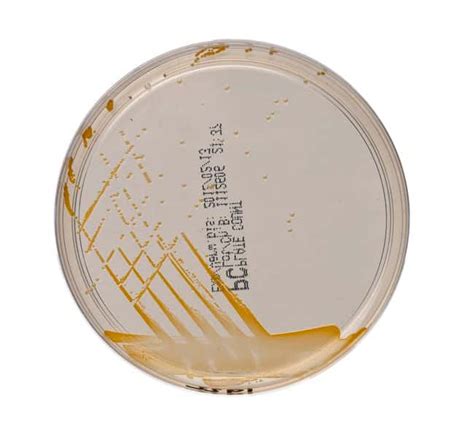 thermo fisher agar plates