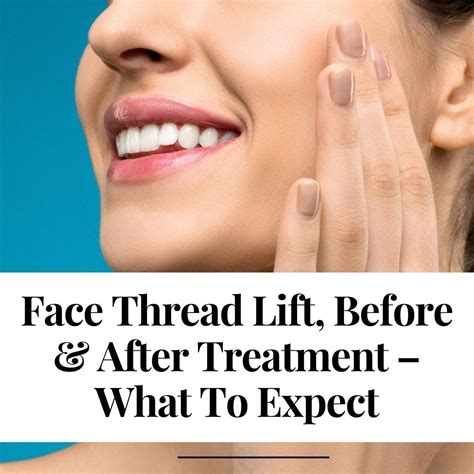 Thread Lift What To Expect