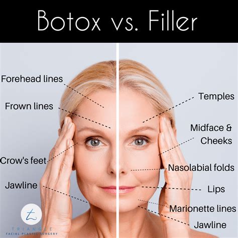 Threading And Botox