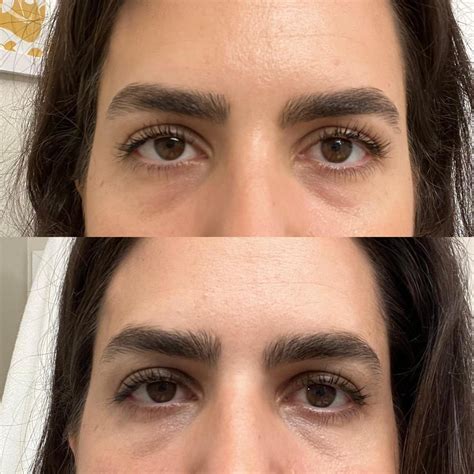 Threading Eyebrows Reddit