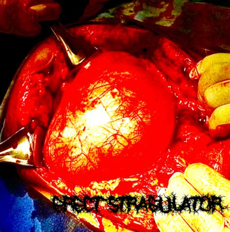 three way chocolate split