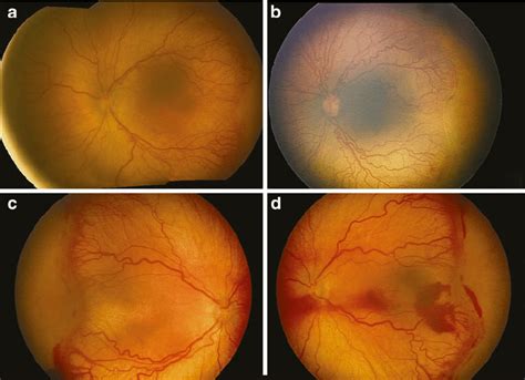 Threshold Rop Definition