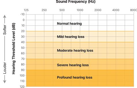 Thresholds In Audiogram