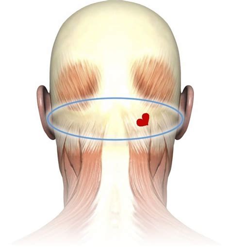 throbbing in back of head uk