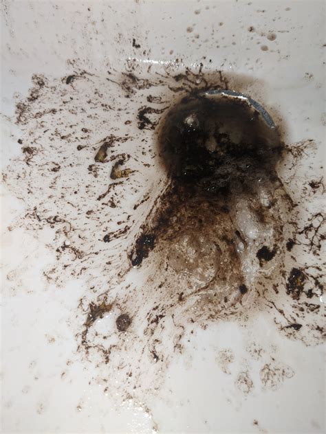 Throwing Up Black Stuff After Drinking