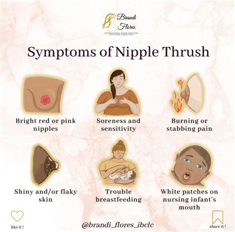 Thrush Nipple Images: A Visual Guide to Identifying and Understanding Nipple Thrush Symptoms