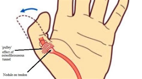 thumb twitching left hand