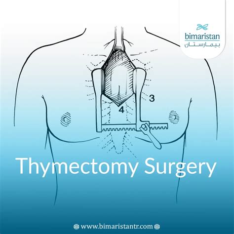 Thymectomy Def