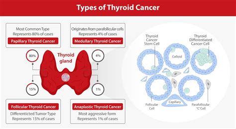 thyroid markers for cancer