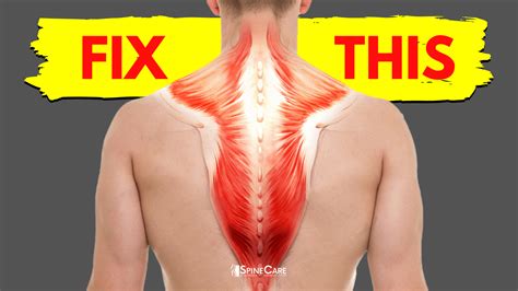 Relieve a Tight Upper Back with Proven Techniques Today