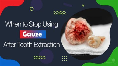 Time to leave gauze in after tooth extraction