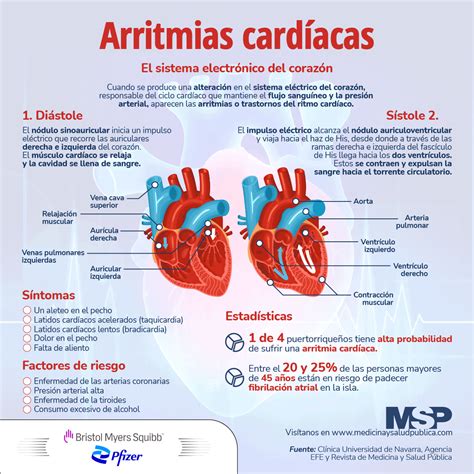 tipos de arritmia cardiaca