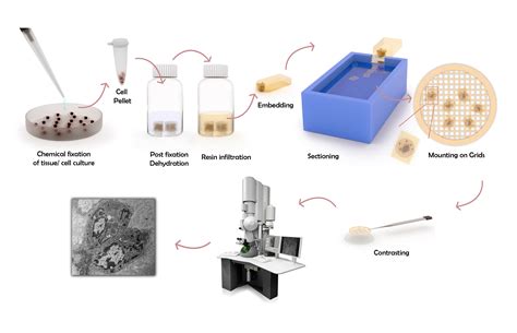 Tissue Fixation Electron Microscopy