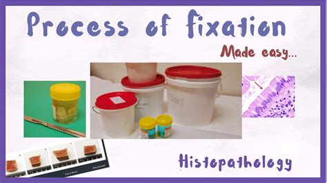 Tissue Fixatives Pathology
