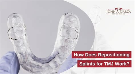 Tmj Repositioning Splint Cost