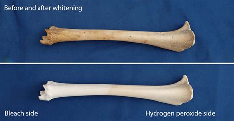 to bleached bone the 3