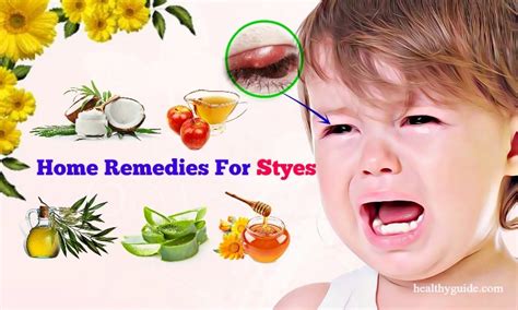 toddler eye stye treatment