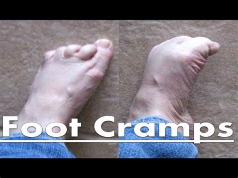 Relieve Painful Toe Cramps at Night: Causes, Prevention, and Effective Relief Strategies