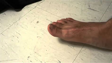 toe feels like it needs to crack