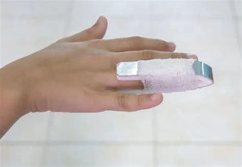 Toe Splint Cpt Code