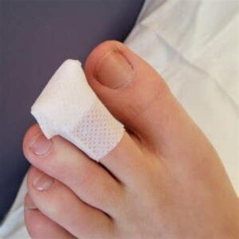 Toe Wound Dressing