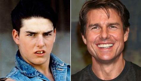 Tom Cruise Plastic Surgery Before and After | Plastic Surgery Magazine