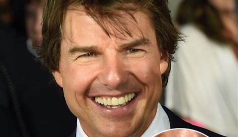 Tom Cruise Middle Tooth Fixed : Tom Cruise Teeth Story Behind Actor S