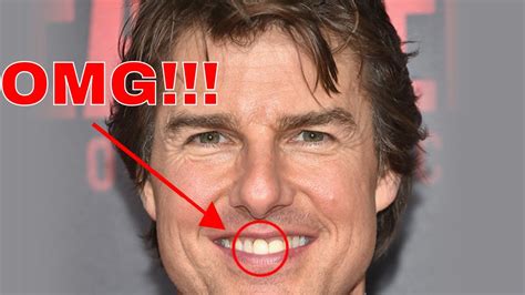 tom cruise front right tooth