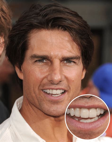 tom cruise smile teeth