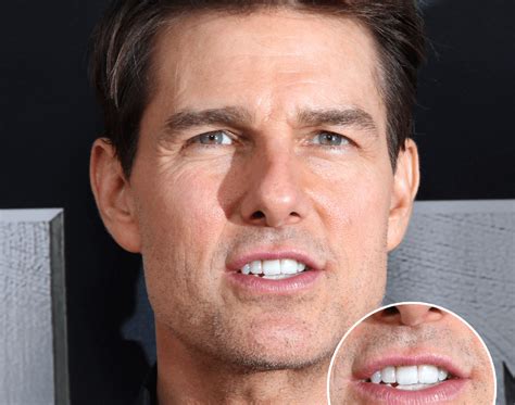 tom cruise teeth