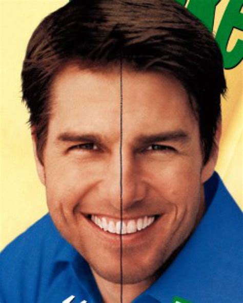 tom cruise teeth before braces