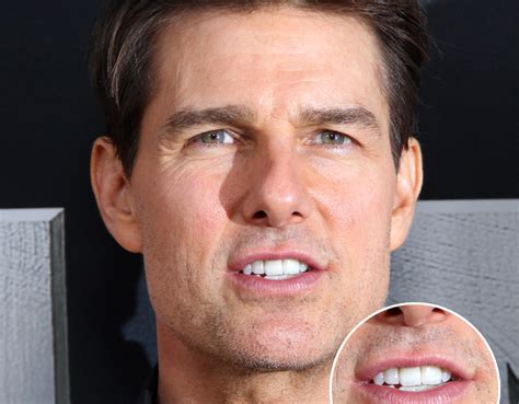 tom cruise tooth in center