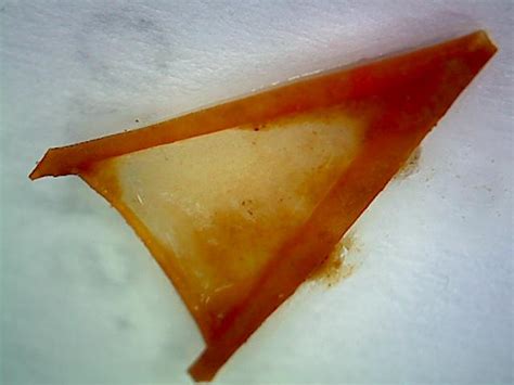 Tomato Peels In Stool