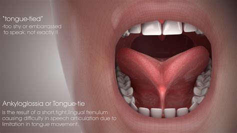 tongue connected to bottom of mouth