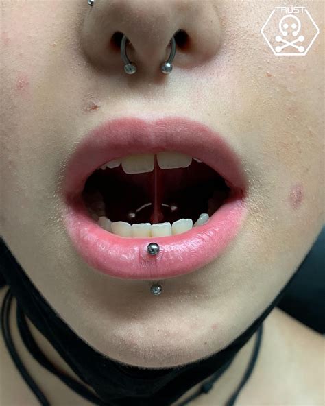 Tongue Piercing Frenulum