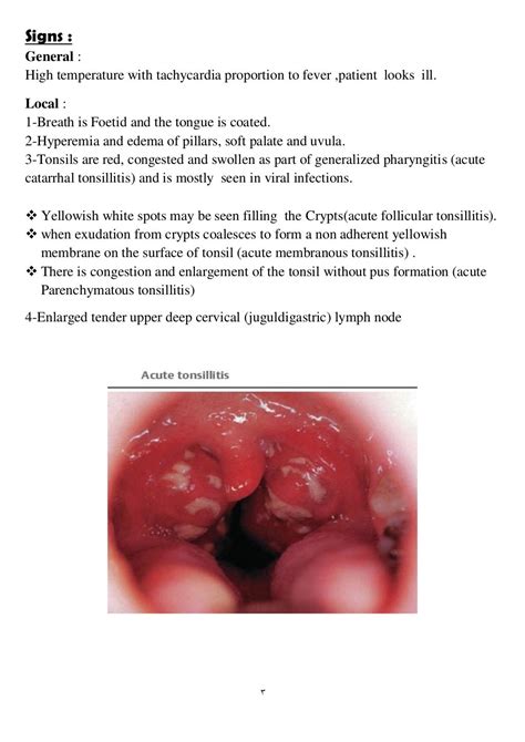 tonsillitis fact sheet