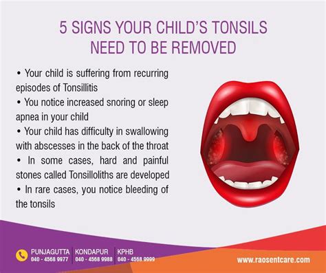 tonsillitis in 2 year old symptoms
