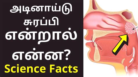 tonsillitis meaning in tamil