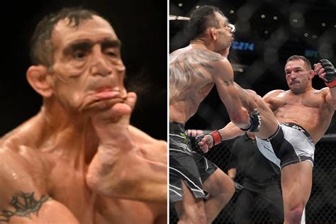 tony ferguson kicked in face