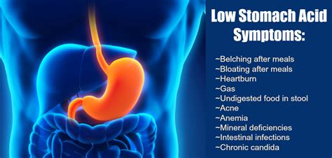 Too Much Stomach Acid Myth or Fact of Acid Reflux Symptoms?