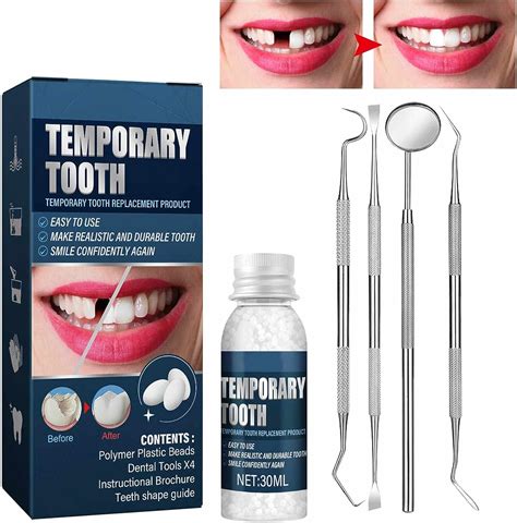 tooth repair kit amazon