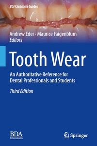 Tooth Wear Bdj