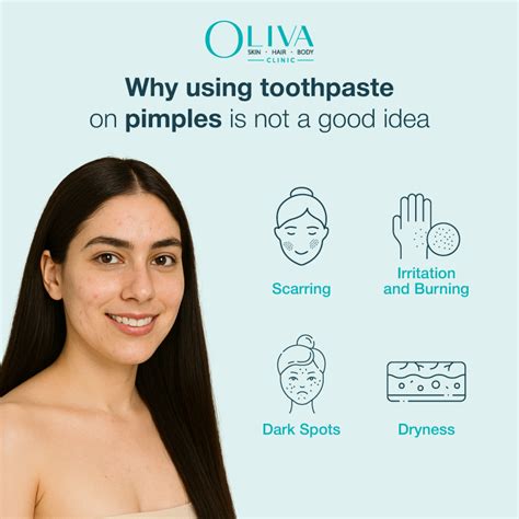 Toothpaste For Pimple Marks