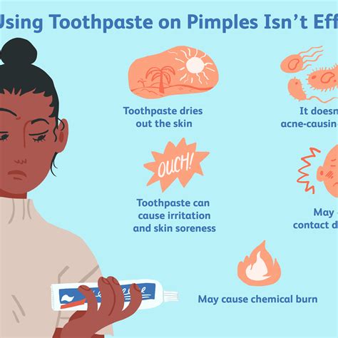 Toothpaste On Pimple How Long