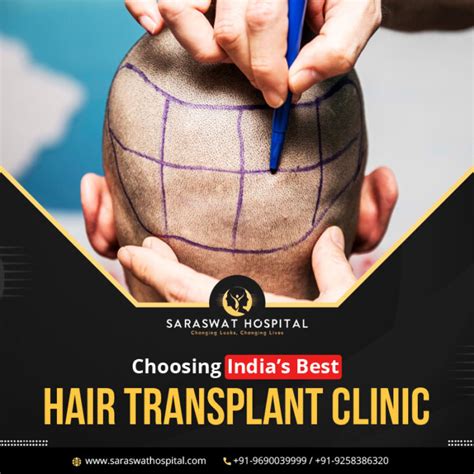 top 10 hair transplant clinic in india