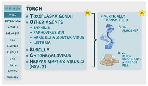 Torches Infections Usmle Congenital Toxoplasmosis Osmosis